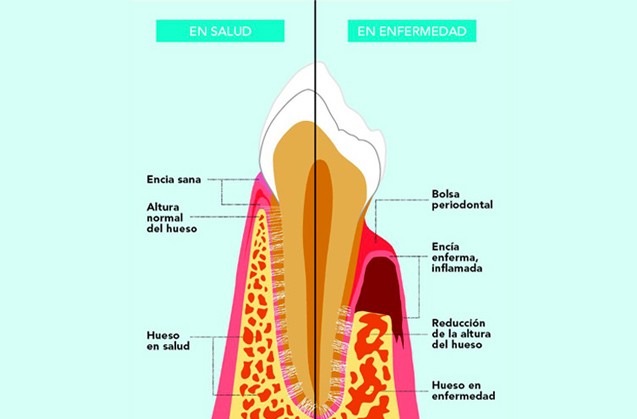 Mantener sano tu periodonto