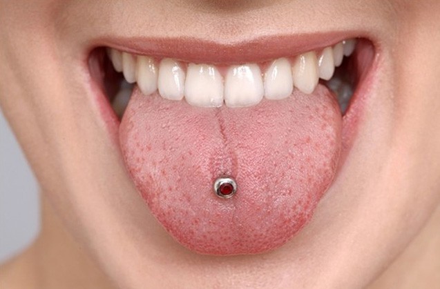 El Piercing oral puede provocar la caida de los dientes
