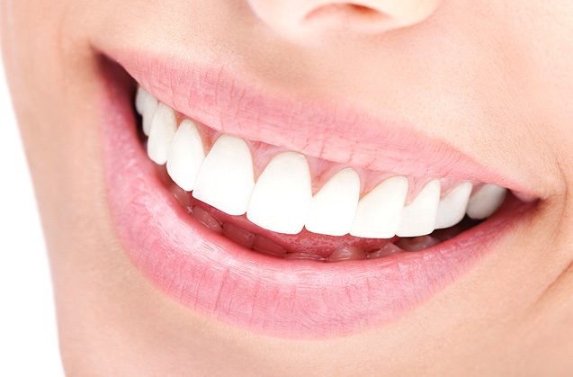 ¿Quieres saber más sobre un blanqueamiento dental?