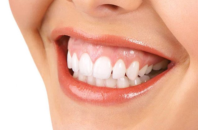 Gingivitis: afecciones comunes