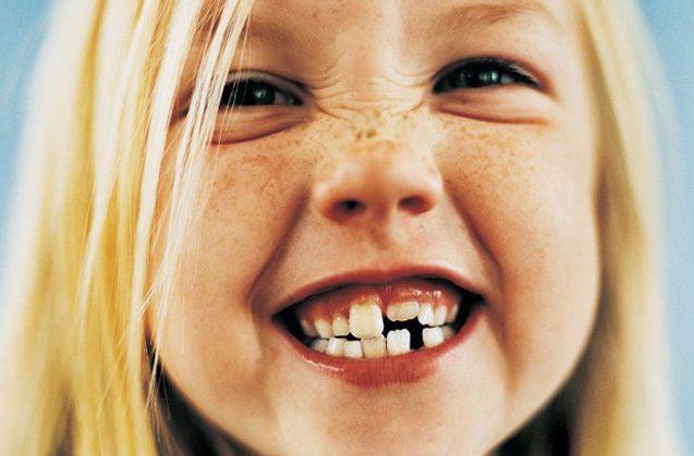 Bruxismo infantil: ¿qué puedo hacer si mi hijo rechina los dientes? 