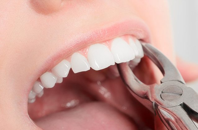 Recomendaciones antes y después de una extracción dental