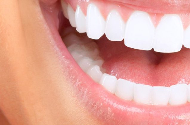 Sonrisa perfecta: Invisalign