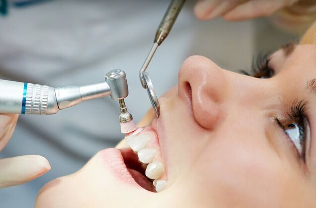 Cuida tus diente, realízate una limpieza dental profesional