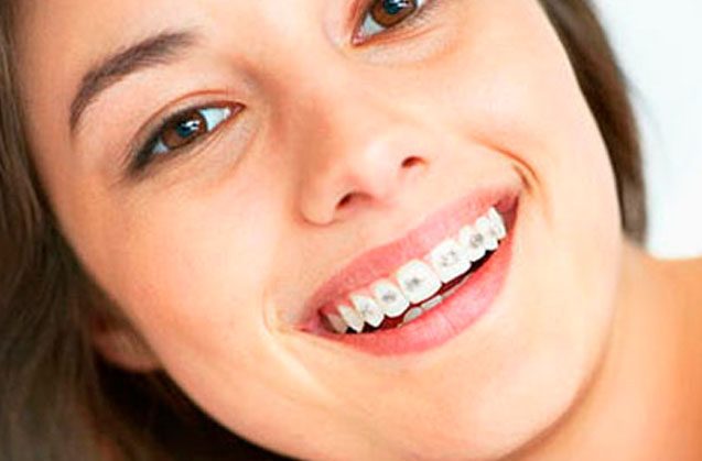 Razones para tener un tratamiento de ortodoncia