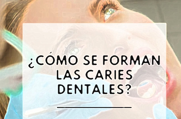 Las caries: cómo y por qué