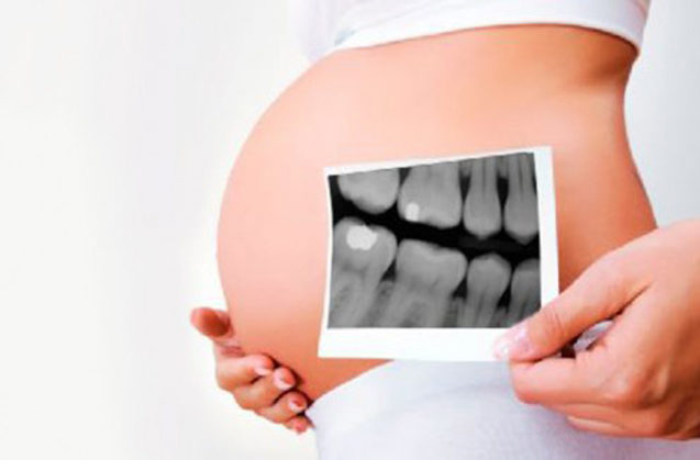La relación entre salud dental y embarazo