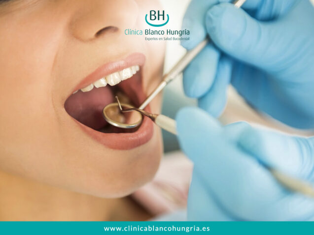 ¿Qué es una endodoncia? Tipos, duración y cuidados