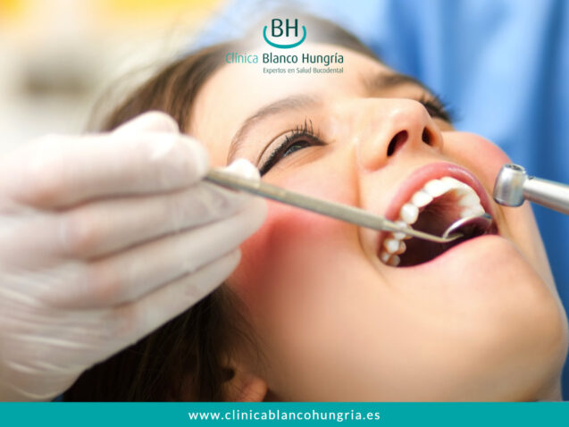 ¿Cuáles son los principales síntomas con los que hay que realizar una endodoncia?