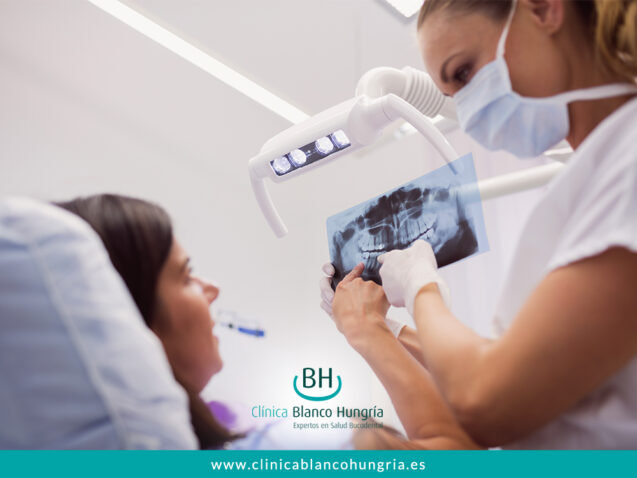 ¿Qué hacer en caso de rotura de prótesis dental?