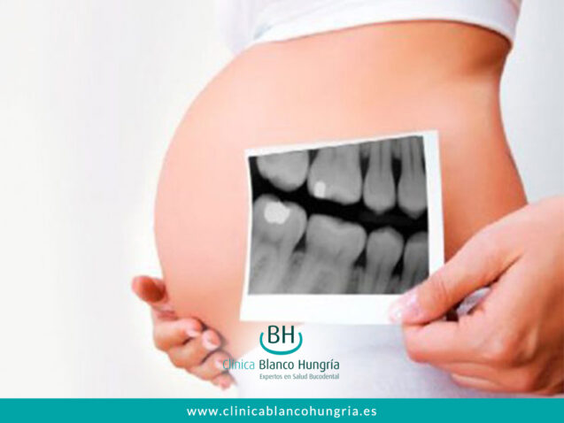 Cuidando tu Salud Dental Durante el Embarazo