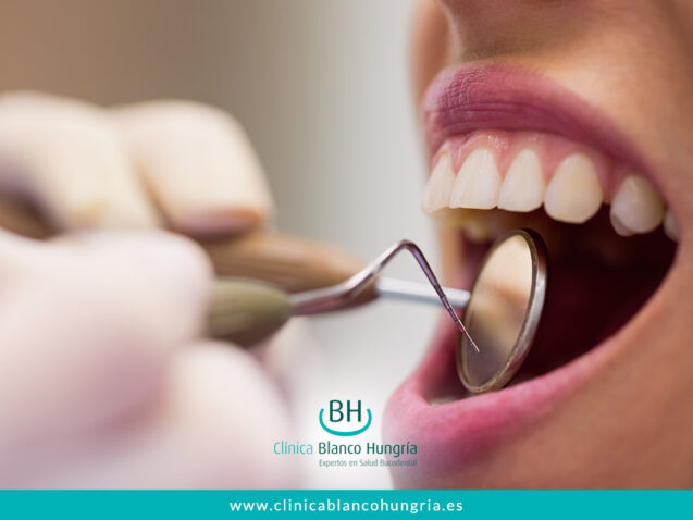 Revisiones dentales: Un componente esencial para una boca sana